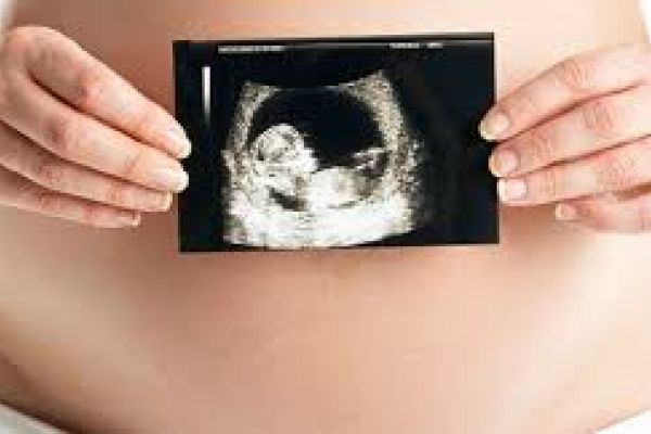 Megmutatni, nem megmutatni?